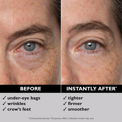Erase Eye Bags in Minutes — Look Refreshed Instantly
