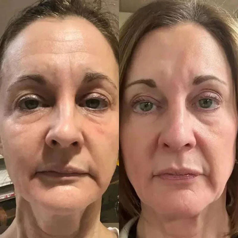 Definitely helped with wrinkles!