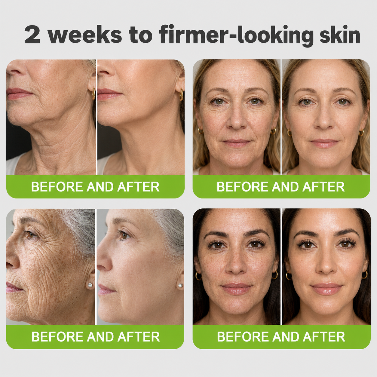 Last Day Promotion 50% OFF：Andydus® Vitamin A Retinol Eye cream