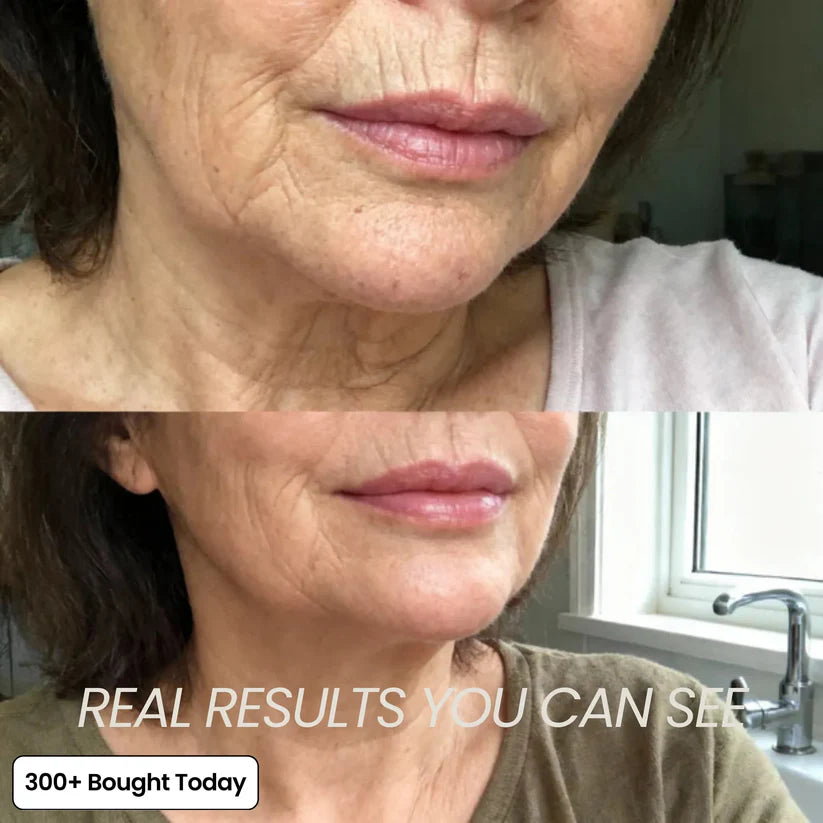 Andydus® REDO PinkCollagen Volume Multi Balm