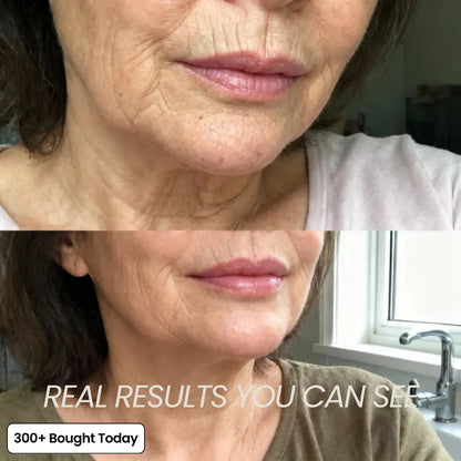 Andydus® REDO PinkCollagen Volume Multi Balm